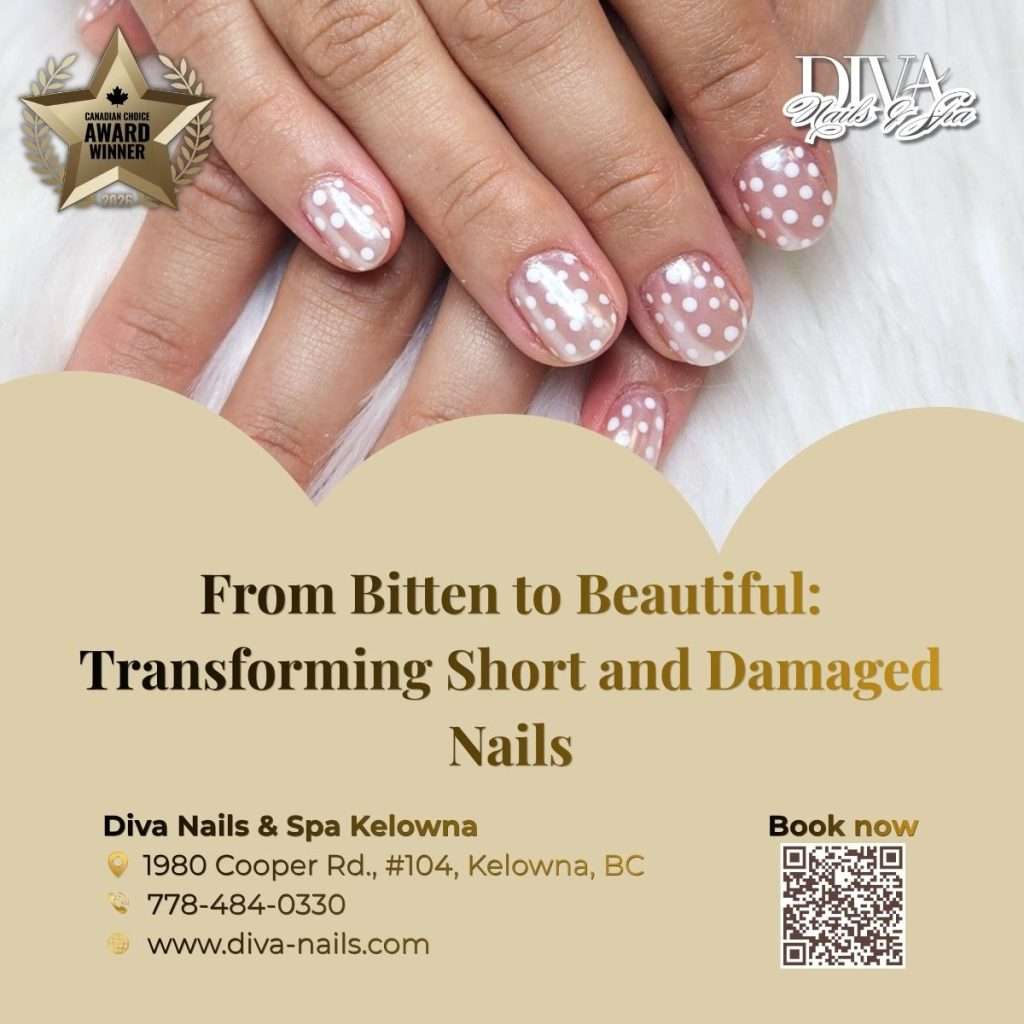From Bitten to Beautiful: Transforming Short and Damaged Nails
